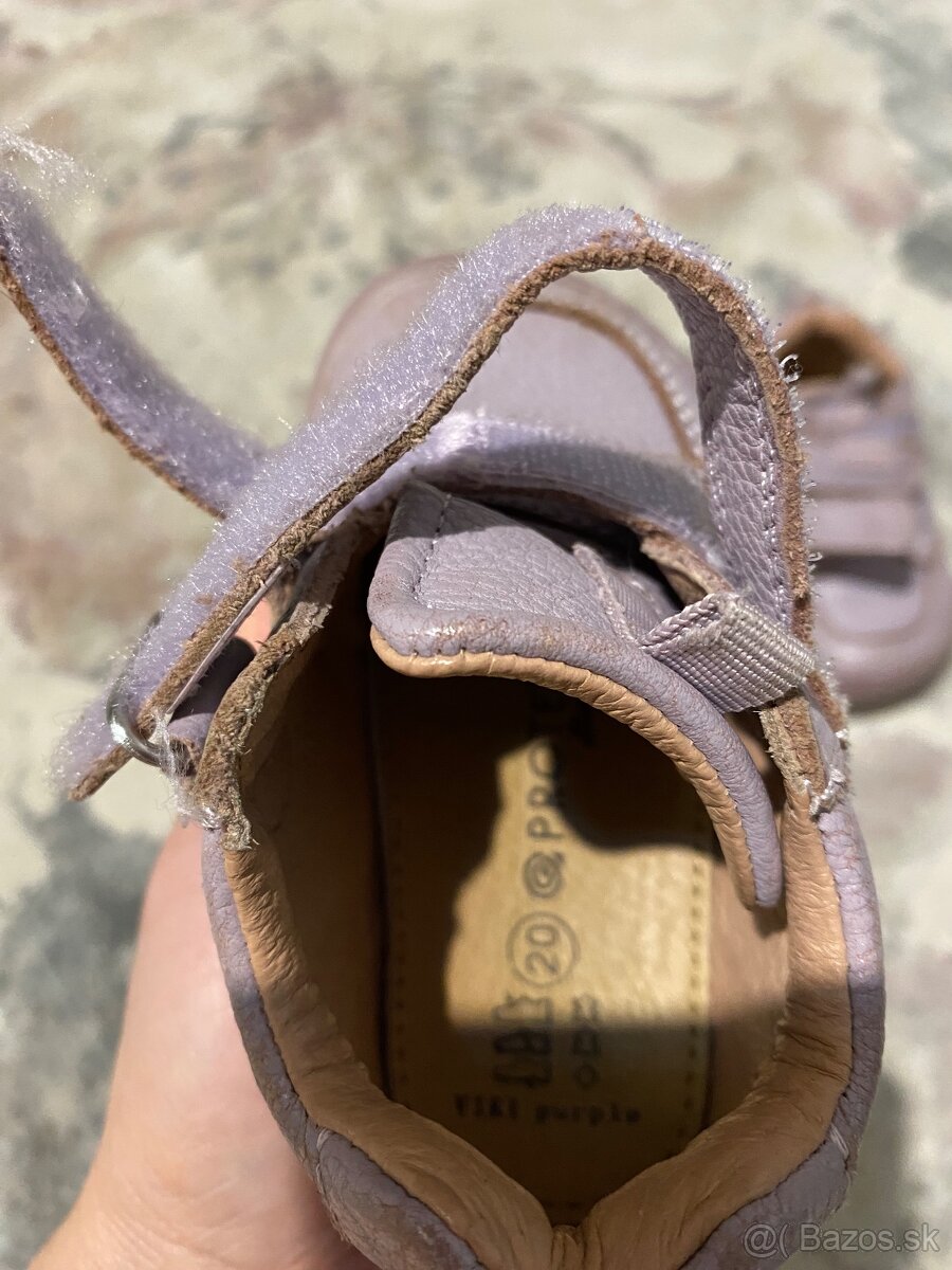 Protetika topánočky - 2