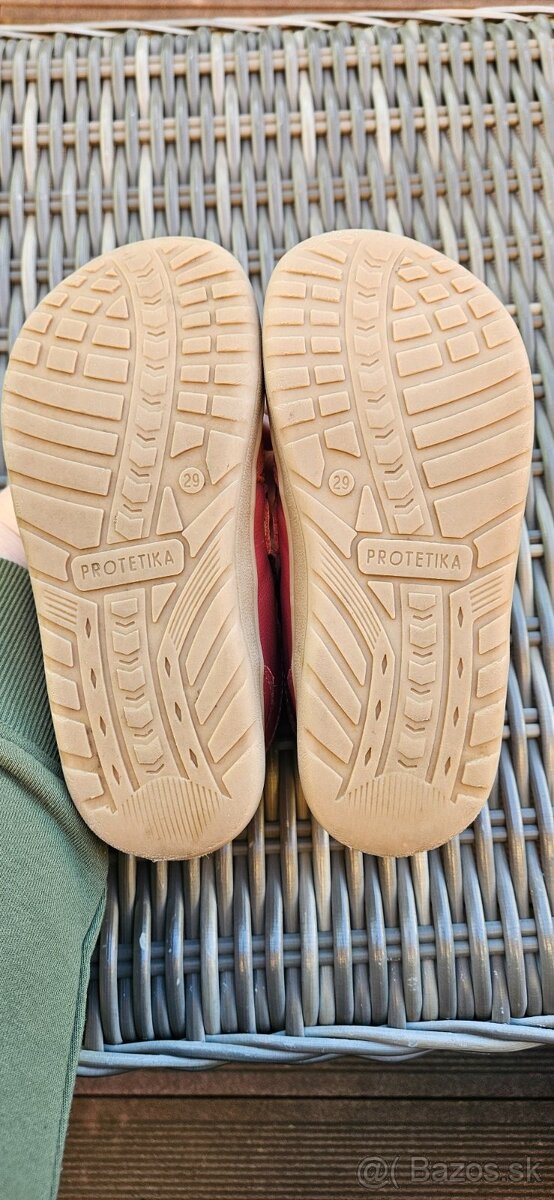 Protetika celorocky v. 29 - 2