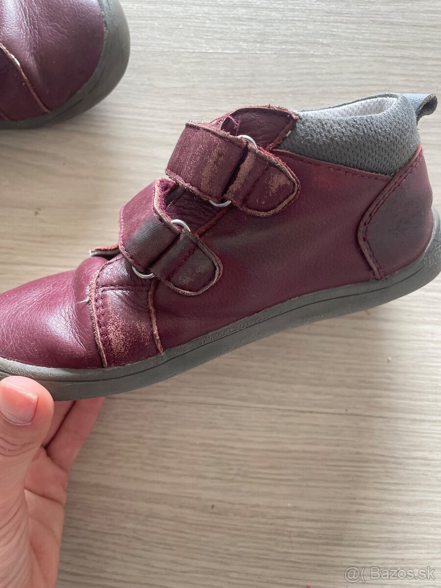 Prechodne topanky Protetika - 2