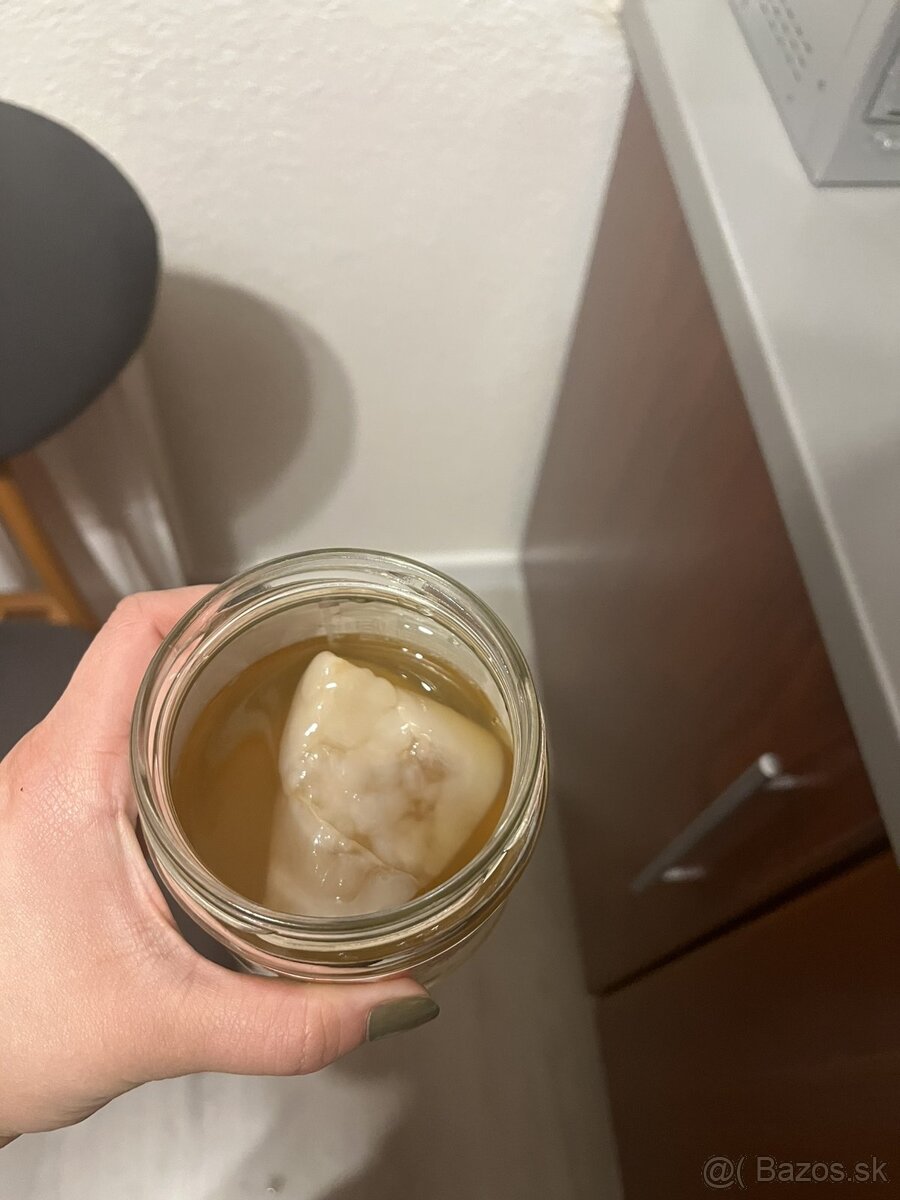 Kombucha - 2