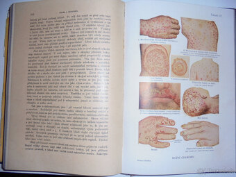 STAROŽITNÉ LEKÁRSKE KNIHY - 2