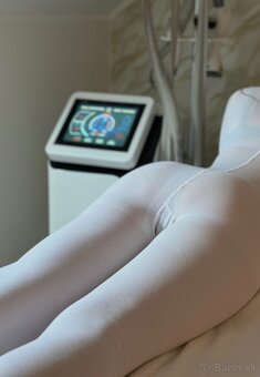 Vela Shape na celulitídu - 2