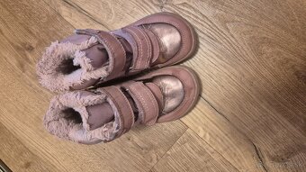 protetika zimne 27 - 2