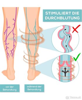 Stimulátor krvného obehu. - 2
