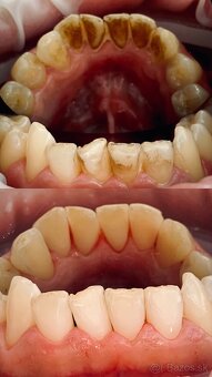 Dentalna hygienicka - 2