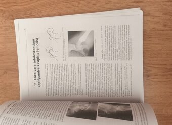 Základy ortopédie - 2