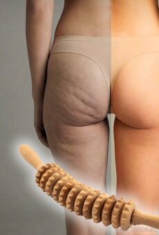 Maderoterapia Topoľčany - 2