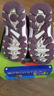 Dievcenske cizmicky protetika - 2