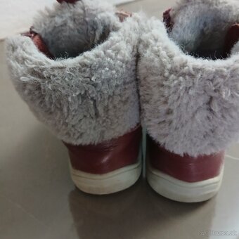 Zimne topanky protetika 25 - 2