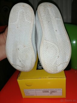 Protetika prorelax velkost 21 - 2