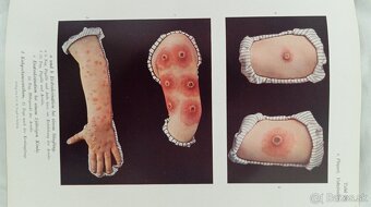 Staré lekarske knihy - 2