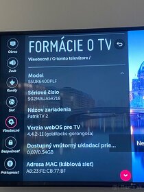 65'' UHD TV LG, webOS Smart TV - 2