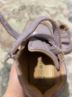 Protetika topánočky - 2