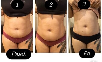Vibroslimfit+Rollcupping - 2