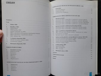 Myelodysplastický syndrom - Diagnostický atlas - 2