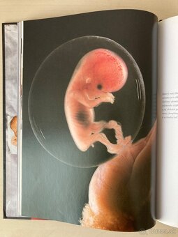 Zazracna cesta do zivota - 2