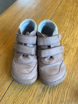 Celorocky protetika barefoot - 2