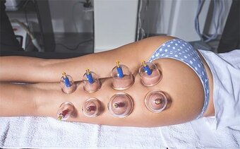 MASAZ,KOZMETIKA,MADEOTERAPIA - 2