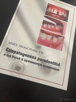 Etiopatogenéza parodontitíd Dentálna hygiena - 2