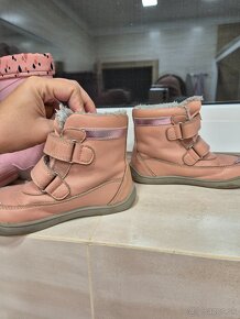 protetika zimne 26 - 2