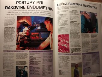 Zdravoveda pre ženy - 2