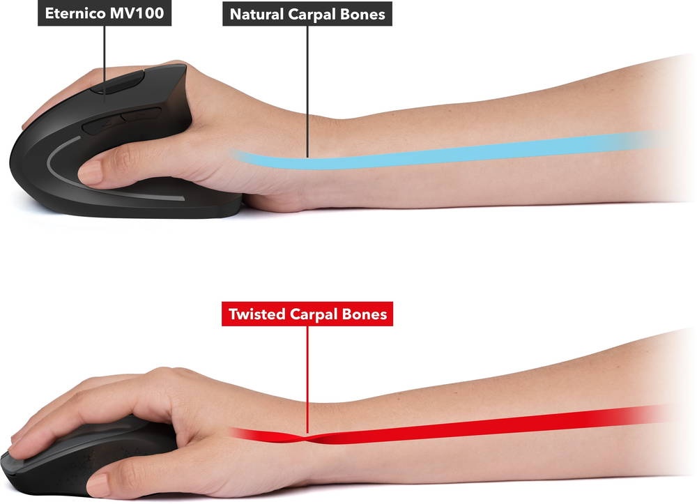 Vertikálna PC myš pre ľavákov - 3