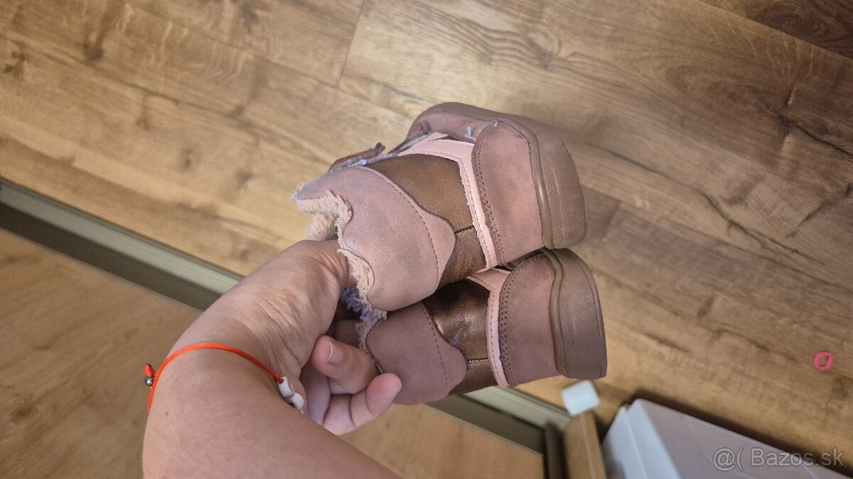 protetika zimne 27 - 3