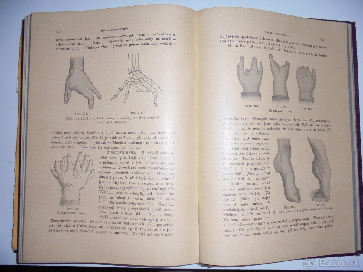 STAROŽITNÉ LEKÁRSKE KNIHY - 3