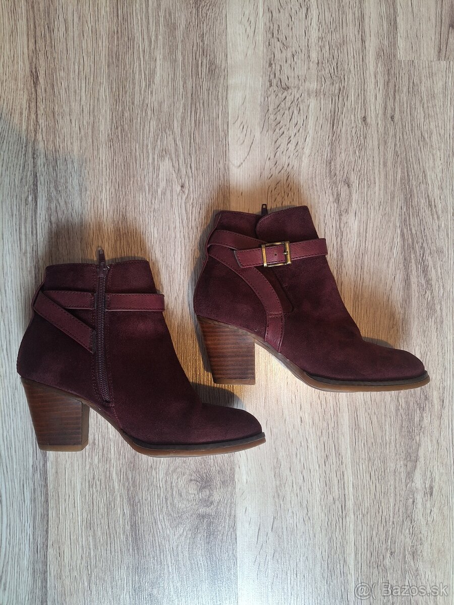 Čižmičky damske viac druhov - 3