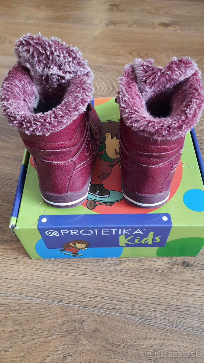 Dievcenske cizmicky protetika - 3