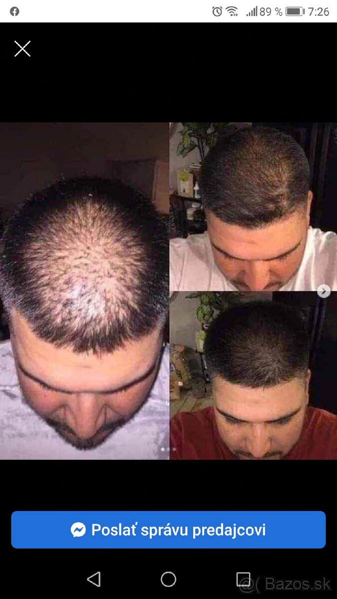 Cesnakový šampón 2kusy 13e - 3