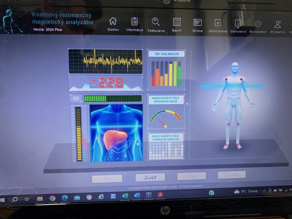 Analyzátor zdravotného stavu - 3