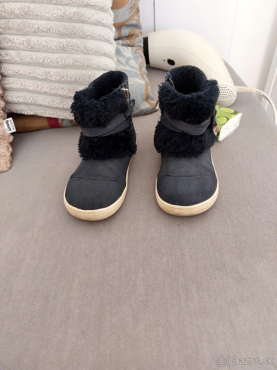 clenkové topánky - 3