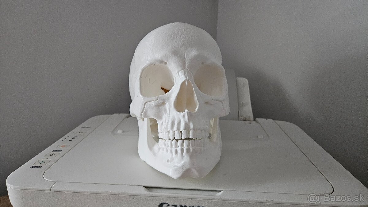 Lebka - 3