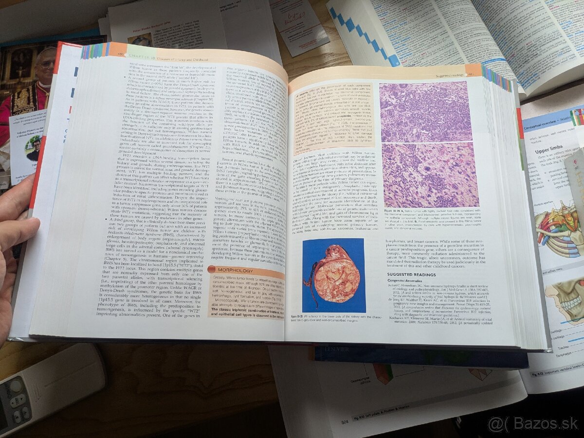 Pathologic Basis of Disease - 3