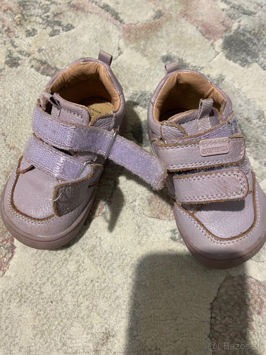 Protetika topánočky - 3