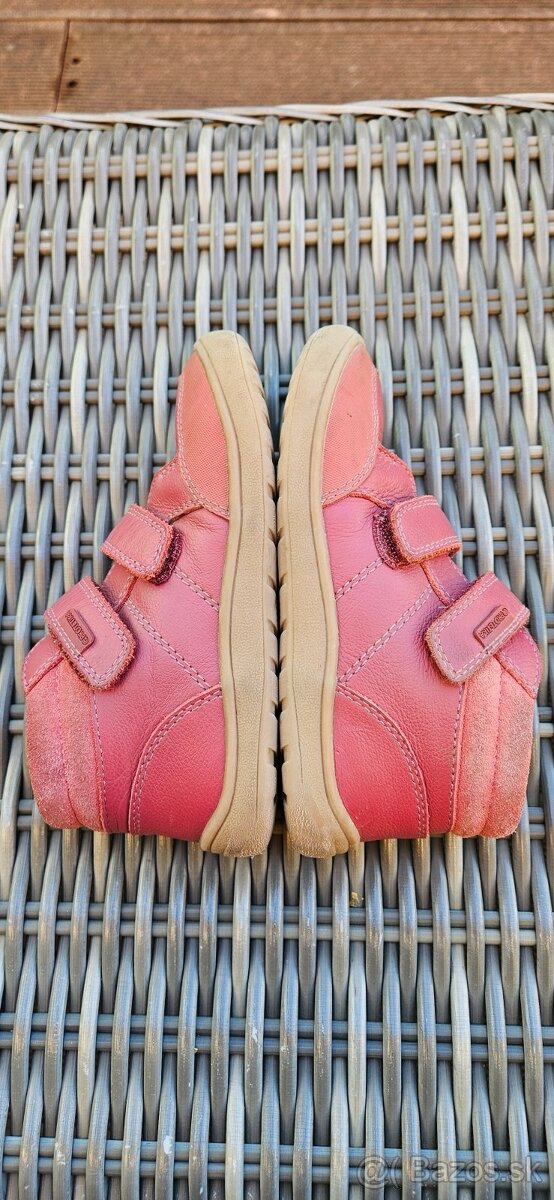 Protetika celorocky v. 29 - 3