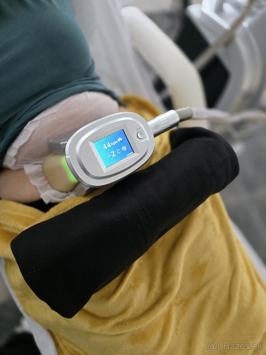 Kryolipolýzny prístroj - 3