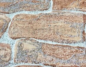 Vliesová tapeta - 3