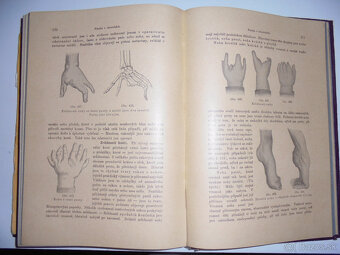 STAROŽITNÉ LEKÁRSKE KNIHY - 3