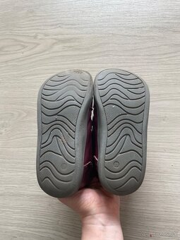 Prechodne topanky Protetika - 3