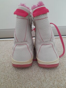 Zimna obuv protetika - 3