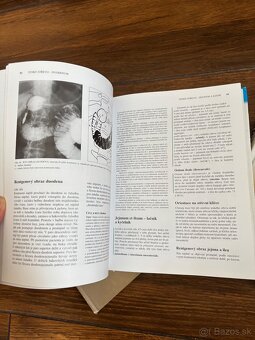Anatomia Čihak 1,2,3 - 3