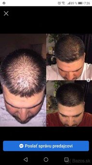 Cesnakový šampón 2kusy 13e - 3