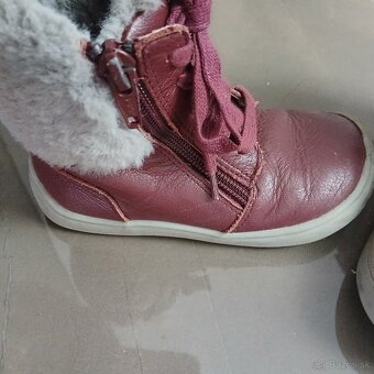 Zimne topanky protetika 25 - 3
