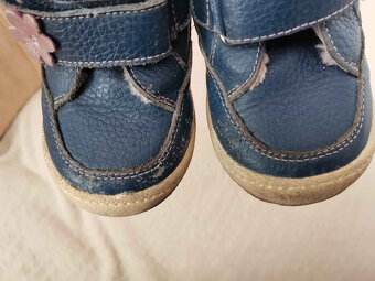 Protetika Mira Navy č. 25 - 3