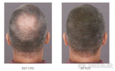 TOPPIK zahusťovacie vlákna- riedke vlasy/alopécia - 3