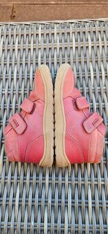 Protetika celorocky v. 29 - 3