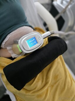 Kryolipolýzny prístroj - 3