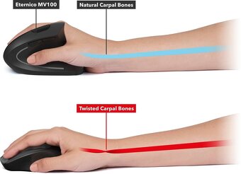 Vertikálna PC myš pre ľavákov - 3